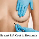 Breast Lift Cost in Romania