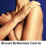 Breast Reduction Cost in Bulgaria