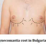 Gynecomastia cost in Bulgaria
