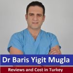 Dr Baris Yigit Mugla Reviews and Cost in Turkey