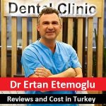 Dr Ertan Etemoglu Reviews and Cost in Turkey – Get an Appointment