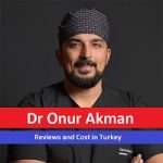 Dr Onur Akman Reviews and Cost in Turkey – Get an Appointment